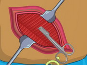 Online game Operate Now: Appendix Surgery