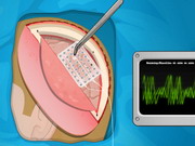 Igrica za decu Operate Now: Epilepsy Surgery