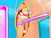 Online igrica Barbie Knee Surgery free for kids