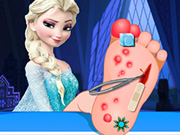 Elsa Foot Surgery