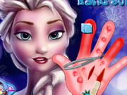 Online game Elsa Hand Surgery