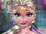 Online igrica Elsa Skin Doctor free for kids