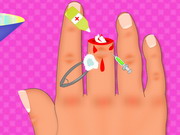 Online igrica Finger Surgery