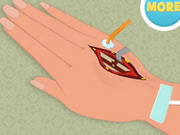 Online game Hand Surgery