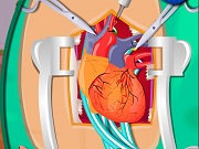 Online igrica Heart Surgery