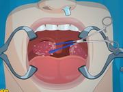 Igrica za decu Operate Now: Tonsil Surgery