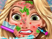 Online igrica Rapunzel Skin Doctor